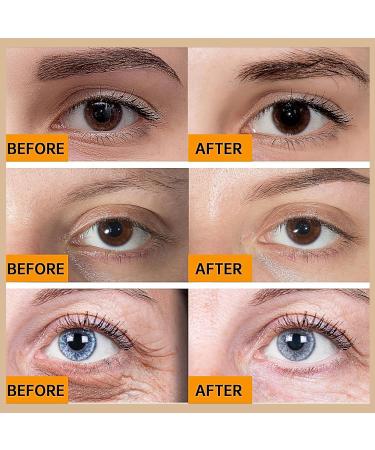 Caffeine Eye Serum Caffeine Under Eye Serum With Caffeine Solution 5% + EGCG Eye Cream For Dark Circles And Puffy Eyes instant wrinkle remover eye serum for dark circles & Eye Bags Removal-Firming - Buy Online on GoSupps.com