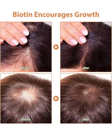 Raw Batana Oil for Hair Growth 100% Natural Organic Batana Oil Prevent Hair Loss Nourishes Scalp Reduce Dry Damanged Hair Unrefined Promotes Hair thickness for Men & Women Hair Care (120 Grams) 120 Grams - Buy Online on GoSupps.com