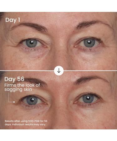 MA LYS TOO-FINE Face Serum for Women - Firming Anti-Aging Serum with Glaucine & Bacillus Ferment - Helps Lift the Look of Sagging Skin on Jawline Cheekbones & Under Eyes (15 mL) Fruity - Buy Online on GoSupps.com