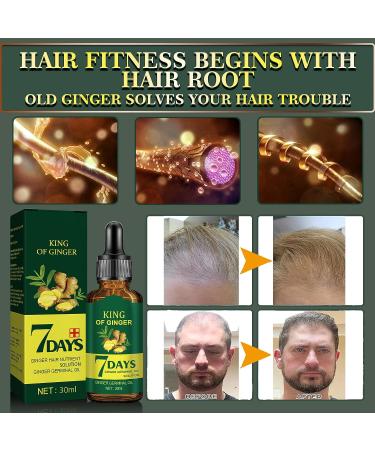Ginger Oil & Biotin Hair Growth Serum - 100% Natural Treatment for Hair Loss Regrowth - Stronger, Thicker, Longer Hair - 1.0 Fl Oz (2 PCS) - Buy Online on GoSupps.com