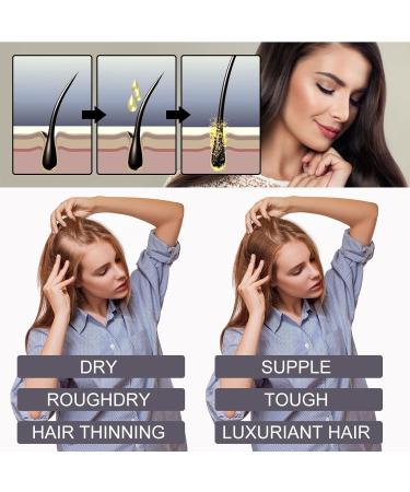 Nourishing Hair Strengthening Oil Hair Repair Oil Hair Strengthening Oil Hair Essential Oil Hair Growth Oil Nourishing Hydrating Hair Growth Vitamin B7 Hair Growth Oil for Men Hairless 30ML - Buy Online on GoSupps.com