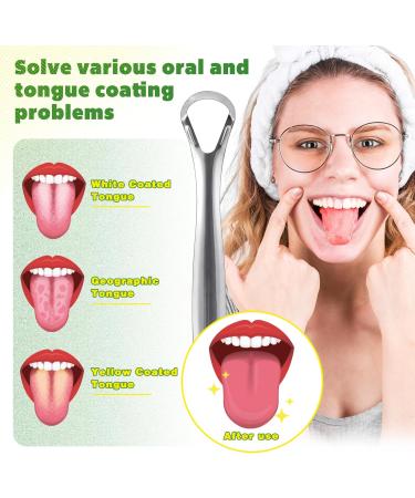 Natural Coconut & Peppermint Pulling Oil for Teeth | Alcohol-Free Mouthwash with Vitamins D & E | Fresh Breath & Gum Health - Includes Tongue Scraper (8 Fl. Oz - Buy Online on GoSupps.com