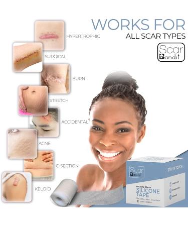 Scarbandit Silicone Scar Sheets - Scars Removal Treatment - Tummy Tuck & C-Section Recovery - 1.57x59 Inch (Pack of 1) - Buy Online on GoSupps.com