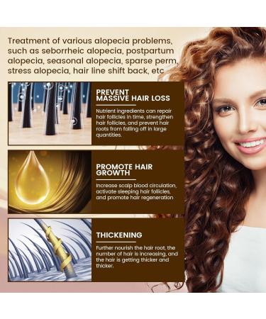 5% Biotin Minoxidil Hair Growth Oil 5% Minoxidil for Men and Women Hair Growth Serum Minoxidil Biotin Hair Growth Serum Nourishes Scalp Stops Hair Loss & Thinning 20ml (20ml) - Buy Online on GoSupps.com
