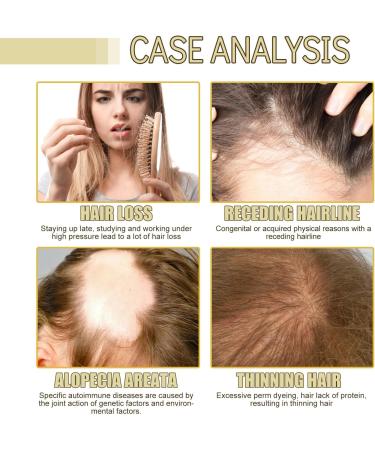 Rosemary Oil For Hair Growth Organic Extra Strength Professional Treatment for Hair Loss Premium Essential Oils Nourishing Split Ends and Dry Scalp for All Hair Types - Buy Online on GoSupps.com