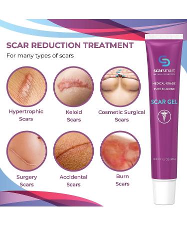 Scar Smart Silicone Scar Gel - Advanced Scar Cream for Surgical Scars, Burns, Stretch Marks, Acne & Keloids - Buy Online on GoSupps.com
