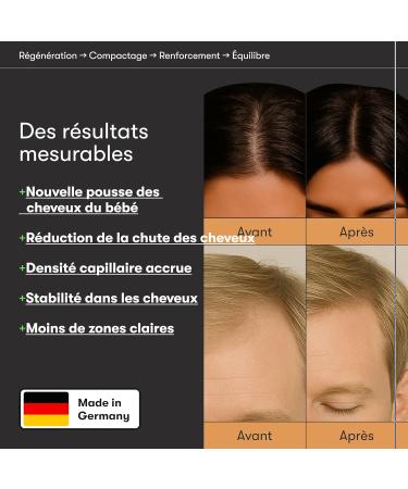Overnight Hair Growth S rum - S rum capillaire en cas de chute de cheveux - Avec romarin panth nol et aloe vera - Favorise la croissance des cheveux - Alternative naturelle au minoxidil - Buy Online on GoSupps.com
