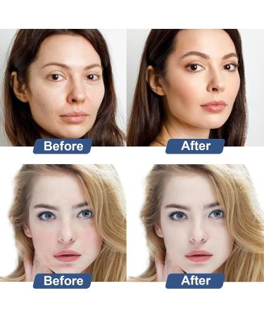 D-Panthenol Liquid (1oz 30g) Concentrate Pro-vitamin B5 Raw Active Ingredient for Skin Hydration Cosmetic Grade Dexpanthenol for DIY Face Hair Nails and Skincare Serum Moisture Cream - Buy Online on GoSupps.com