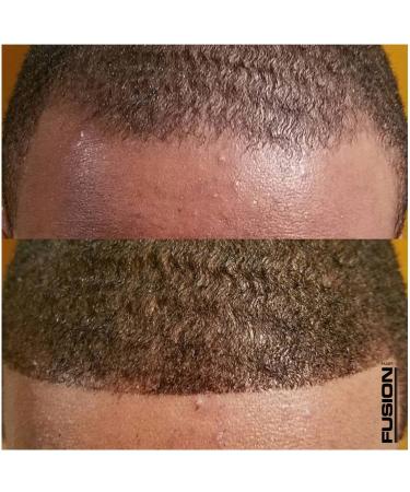 HAIR FUSION Dark Brown: 100% Real Human Hair Fibers for Baldness & Thinning - Root Touch Up, Volumizer - Unisex (1.05 oz) - Buy Online on GoSupps.com