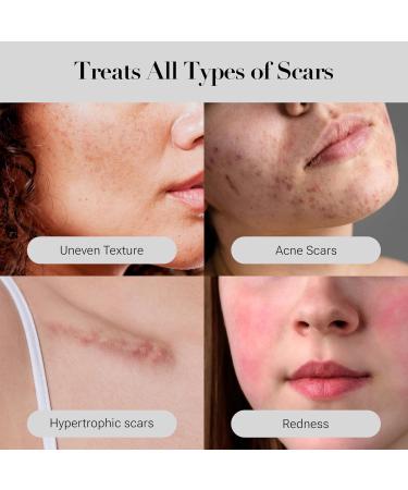 Sucral Overnight Solution Cream - Advanced Dark Spot Corrector for Face 1.01oz | All Skin Types Calming Ingredients - Buy Online on GoSupps.com