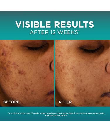 L Or al Paris Bright Reveal 12% Niacinamide + Amino Sulfonic + Ferulic Dark Spot Serum 1oz + Moisturizer Sample - Buy Online on GoSupps.com