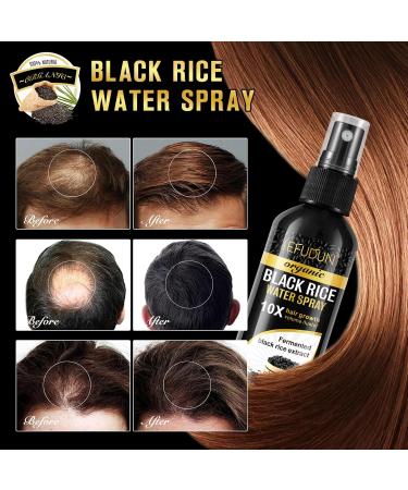 Vedora Organic Black Rice Water Spray - Hair Growth Solution with Castor Oil & Ginger for Thicker Fuller Hair | 100ml - 1 PC - Buy Online on GoSupps.com