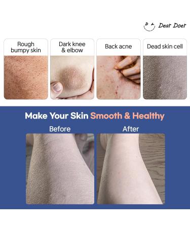  Dear Doer Break Body Scrub in Tube - Refreshingly Exfoliator for Clear Skin/The Hidden Silky Body & Hand Wash | Vegan | 10.14 fl.oz - pH-Balanced 100% Plant-Based Surfactants with Natural PHA LH - Buy Online on GoSupps.com