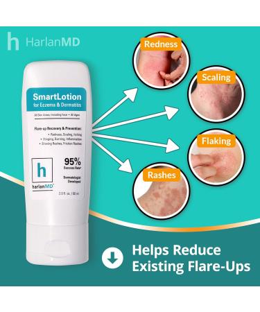 Buy SmartLotion Cream for Dermatitis & Eczema Treatment | Prebiotic Formula 2 Fl Oz - Fast International Shipping - Buy Online on GoSupps.com