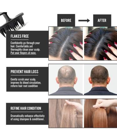 2-Piece Wakisaki Solid Silicone Scalp Massage Brush Set - Mold-Resistant Hair Shampoo & Head Massager (Black) | International Shipping - Buy Online on GoSupps.com
