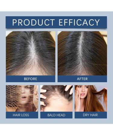 100ML Hair Regrowth Spray - Effective Treatment for Thinning Hair & Hair Loss | Clinically Proven for Men & Women | Thicker Fuller Hair - Buy Online on GoSupps.com