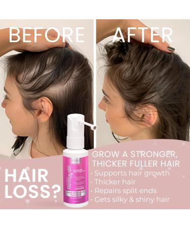Remixidil Minoxidil 2% Hair Growth Spray for Women - Thinning Hair Regrowth & Thickening Treatment | Fast International Shipping - Buy Online on GoSupps.com