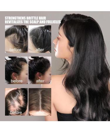 Jeruytgh Natural hair oils for Organic Hair Density Oil Hair Thickening Scalp Oil Scalp oil for thickness 70 ml hair growth oil Organic hair thickening oil for daily use - Buy Online on GoSupps.com