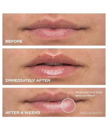 BABE ORIGINAL Cloud 9 Peptide Lip Serum | Daily Lip Treatment with Cloudberry Oil Mushroom Extracts Hyaluronic Acid for Dryness & Fine Lines | Smoothing & Hydrating Lip Moisturizer | Vegan Lip Care - Buy Online on GoSupps.com