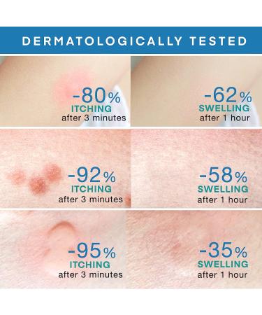 HEALPOOL Insect Bite and Sting Relief - Fast Natural Treatment for Itching & Swelling, Chemical-Free for Pregnant Women & Kids - Buy Online on GoSupps.com
