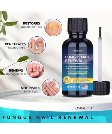 Extra Strength Toenail Fungus Treatment - Natural Oils for Men & Women | 2pcs - Effective Toenail & Fingernail Solution - Buy Online on GoSupps.com