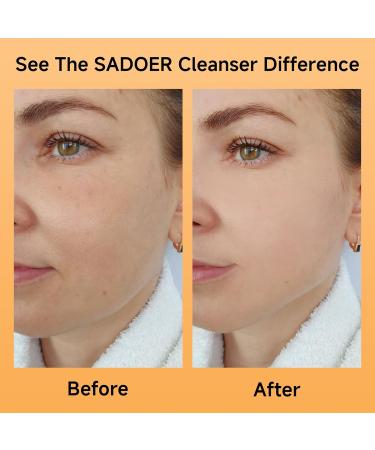 5X Vitamin C Face Cleanser 100g(2 Bottle),SADOER Facial cleanser Niacinamide & Hyaluronic Acid, Gentle Pore Refining Daily Wash for Oily &Dull Skin,Clear,Oil Balancing,TIKTOK Popular Skincare Gift 2 Face Cleanser - Buy Online on GoSupps.com
