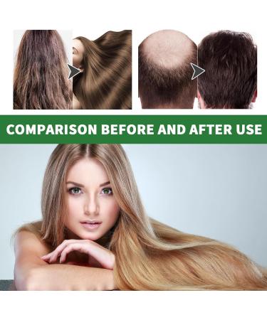 Raw Castor Oil for Hair Growth 120ml Castor Oil Pure Butter Hair Conditioner for Damage Protective Moisture Recovery Miracle Oil for Healthier Thicker Fuller Hair - Buy Online on GoSupps.com