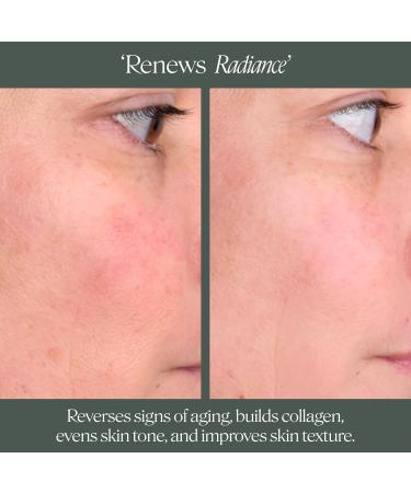 Doctor Rogers Night Repair Treatment REFILL. Restoring & Hydrating Anti-Aging Face Serum with Glycolic Acid 1 Ounce (30 ml) 1 Fl Oz Refill - Buy Online on GoSupps.com