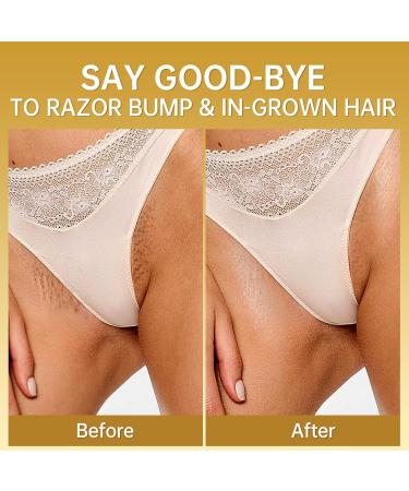 LA.PERSONAL Ingrown Hair Treatment | Razor Bump & Burn Remover Oil for Men & Women | 40 ML | Bikini Legs & Underarm Care - Buy Online on GoSupps.com