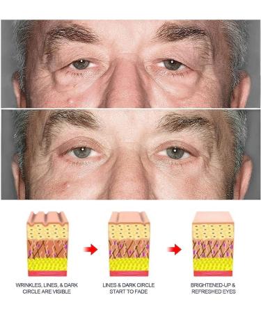 RENTANAC East Moon Mens Cool Tender Eye Cream Instant Firm Eye Tightener Eye Bag Cream Anti Aging Eye Cream Under Eye Awaken Peptide Depuffing Eye Gel Reduces Puffiness - Buy Online on GoSupps.com