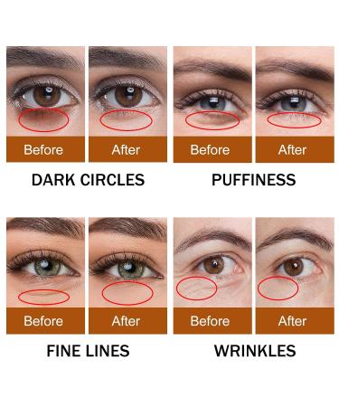 Shop Birthday Gifts for Women | Caffeine Eye Serum for Dark Circles & Puffy Eyes Treatment - Buy Online on GoSupps.com