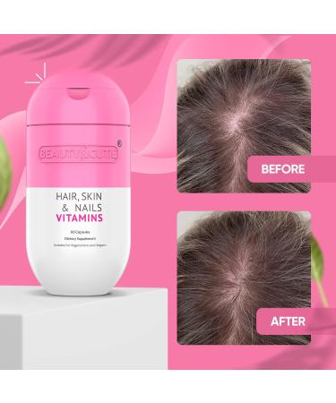 BEAUTY AND CUTIE Hair Skin Nails Vitamins - Hyaluronic Acid Biotin Supplement for Women - 60 Count - Buy Online on GoSupps.com