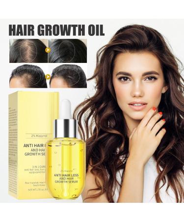 Return Ginger oil for hair Ginger Regrowth Oil Hair Serums50 ml Hair Serums Oil Prevention of hair loss and natural serums for thicker stronger and longer hair Men and women Retorno - Buy Online on GoSupps.com