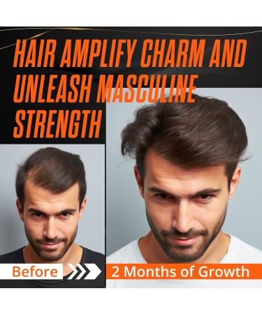 Abera Hair Growth Serum | Natural Hair Loss Treatment with Biotin & Castor Oil for Hair & Beard Regrowth - Shop Now - Buy Online on GoSupps.com