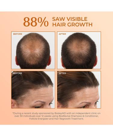 BosleyMD 3-Piece Hair Kit with Saw Palmetto for Longer, Thicker, Fuller Hair - Includes Shampoo, Conditioner, and Treatment - Color Safe - Buy Online on GoSupps.com