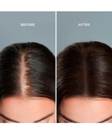 MOEHAIR Travel Size Shampoo & Conditioner Set | Color Safe Hair Loss Treatment | 3.4 Fl Oz | Perfect for Travel - Buy Online on GoSupps.com