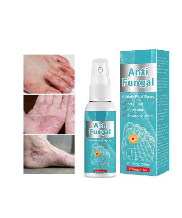 Athletes Foot Treatment Spray, Foot Fungi Treatment with Natural Ingredients, Foot Spray for Feet Itchy, Sweating, Peeling, Blisters