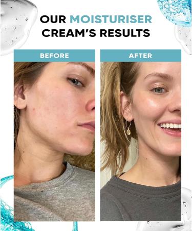 Hyaluronic Acid Moisturiser Face Cream - Hydrating Skincare with Vitamin E & B5 to Instantly Soothe and Replenish the Skin's Moisture Barrier - Intensely Nourishing Day Cream for Women and Men 50ml - Buy Online on GoSupps.com