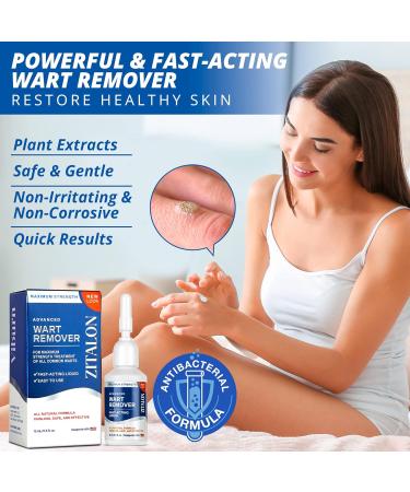 ZITALON Wart Remover - Effective Plantar Wart Removal Treatment - Buy Online on GoSupps.com