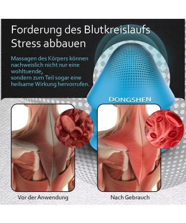 Buy Dongshen Triggerpunkt Trigger - Original Sticky Suction Cup for Muscle Pain Relief | Shoulder Neck Back & Leg Tension Relief | Blue - Buy Online on GoSupps.com