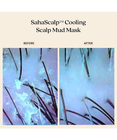 Fable & Mane SahaScalp Cooling Mud Mask | Dry Itchy Scalp Treatment | Scalp Moisturizer & Detox - 6FL oz - Buy Online on GoSupps.com
