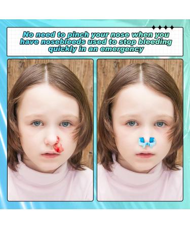 Stop Nosebleeds Clip - Nasal Bleed Stopper for Kids & Adults - Emergency Accident Relief - Blue & Green (100 Pcs) - Buy Online on GoSupps.com