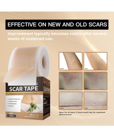 Medical Grade Silicone Scar Tape - 164x1.57 Roll for Scar Removal | C-Section Tummy Tuck Keloid & Surgical Scars | Reusable Silicone Scar Sheets - Buy Online on GoSupps.com