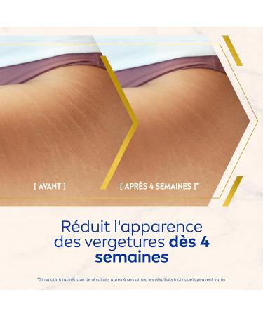 NIVEA Luminous630 Anti-Stretch Marks Body Oil (1 x 100 ml) Anti-Spot Body Care 48 Hour Hydration Reducer Stretch Marks Women's Care for All Skin Types - Buy Online on GoSupps.com