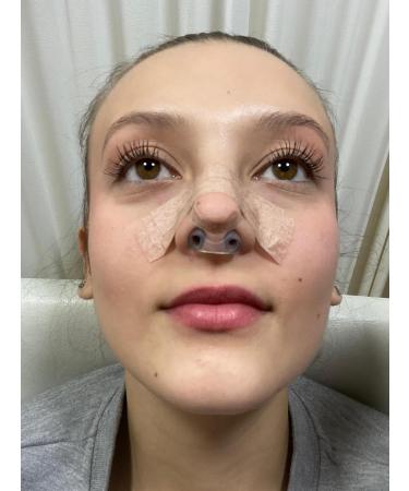 NANOVITA Nostril Retainer Rhinoplasty + Micropore Surgical Tape | Nostril Shaping After Nose Surgery | Nose Shaper Device Made of 100% Medical Silicone (- 5 -) - Buy Online on GoSupps.com