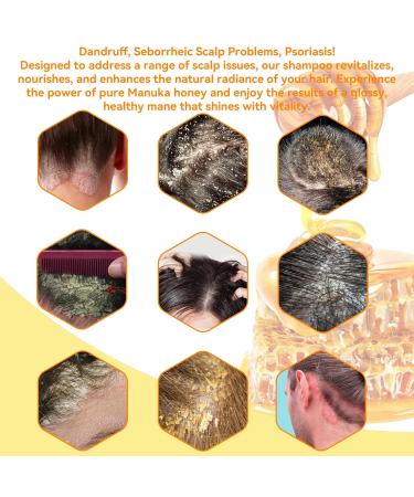 Manuka Honey Shampoo for Folliculitis & Dandruff Relief - Anti-Dandruff & Antifungal Formula 8 Fl Oz - Buy Online on GoSupps.com