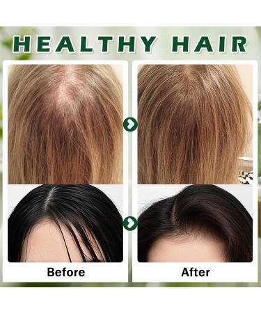 100% Pure Organic Batana Oil for Hair Growth | Natural Raw Batana Oil to Prevent Hair Loss & Promote Thickness - Buy Online on GoSupps.com