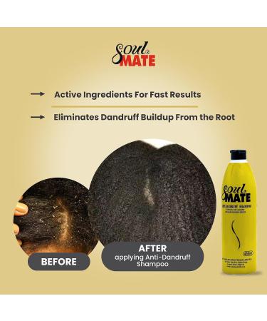SOUL MATE Anti-Dandruff Shampoo with Sericin | 15.2oz Scalp Exfoliator for Men & Women | Dandruff Free & Itch Relief Hair Treatment - Buy Online on GoSupps.com