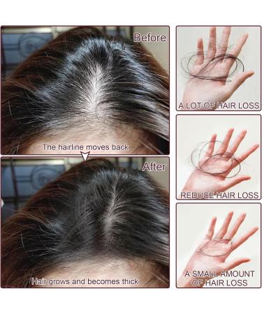 LINXINS Batana Oil for Hair Growth Raw Batana Oil Batana Oil Organic Botana Oil Repairs Damaged Hair Reduces Hair Loss - Miracle Oil for Healthier For Hair Growth (1PC - 120ml) - Buy Online on GoSupps.com