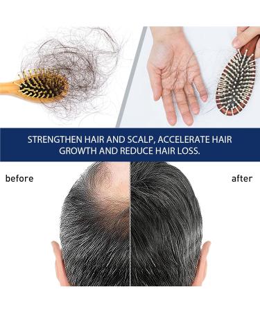 Alopecia Cr me de croissance des cheveux p te capillaire naturelle cr me paississante des cheveux formule naturelle pratique compacte 20 g pour homme et femme adulte - Buy Online on GoSupps.com